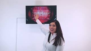 Si tienes espacios entre los dientes no permitas que te hagan esto 😨😨😳