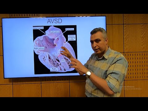 AVSD (AV Canal) (En) - Hatem Hosny