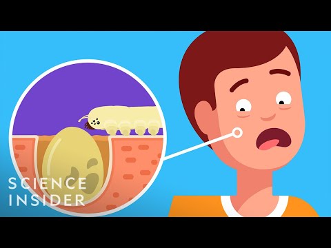 在你臉上下蛋的蟲子。 (The Bugs That Lay Eggs In Your Face)