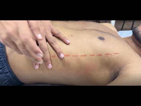 Percussion of liver and spleen: Applied clinics; Department of Medicine; DMIHER