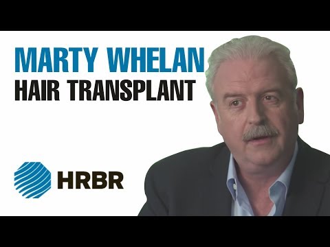 Marty Whelan Hair Transplant Video onial - HRBR - Hair Restoration Blackrock