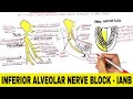 Inferior Alveolar Nerve Block IANB
