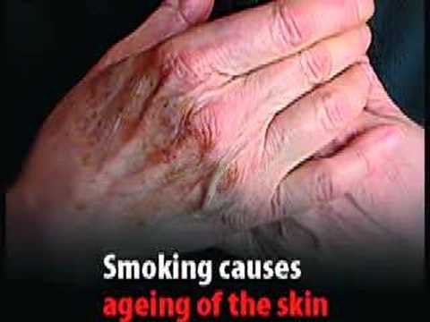 Smoking Advert. QEGS