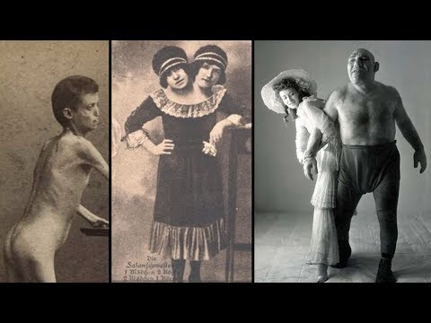 The Dark History of FREAK SHOWS