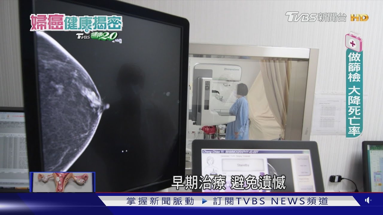 台灣每天約7.3人死於乳癌　「做這些」降低41%乳癌死亡風險