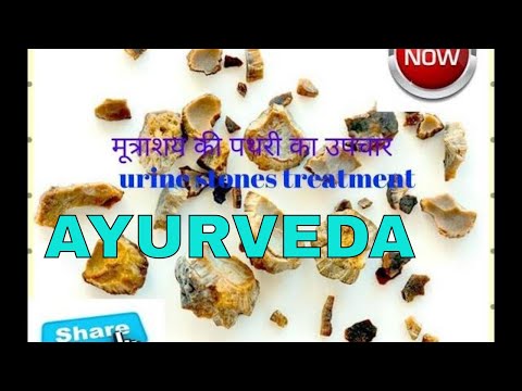 kidney stone home remedy in hindi/kidney stone treatment at home in hindi/indian ayurveda channel Video