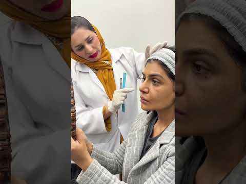 Actress & model Iffat Omar gets a thread lift—watch till the end to see her reaction!