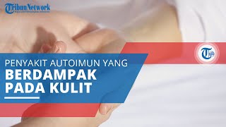 Dermatitis Herpetiformis, Penyakit Autoimun yang Berdampak pada Kulit karena Bereaksi dengan Gluten