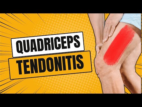 Quadriceps Tendonitis or Tear: Top 3 Exercises (DIY Physical Therapy)