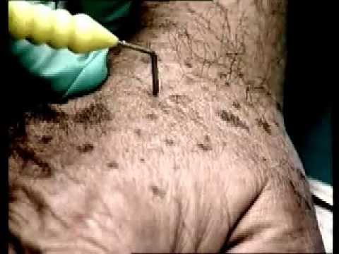 Pacco di faccia di decolorazione di pelle Decolorazione di succo di limone per la pelle
