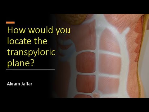 How Would You Locate The Transpyloric Plane?