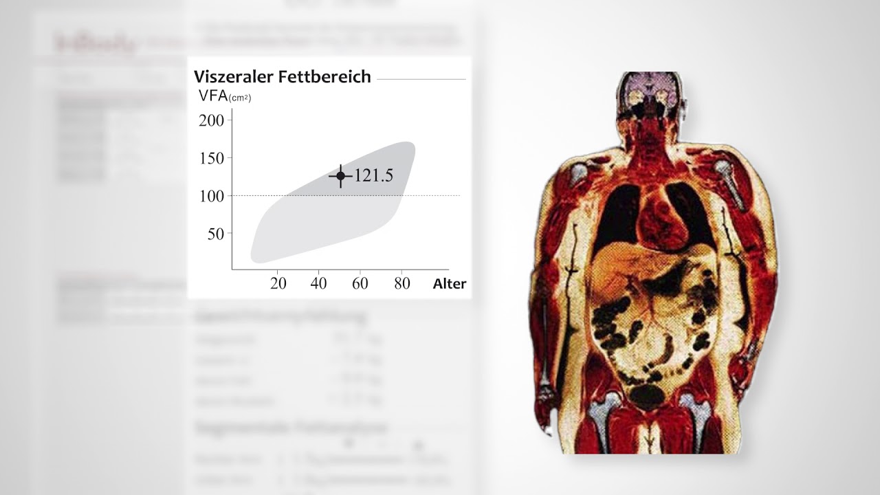 Analyse fundiert erklärt