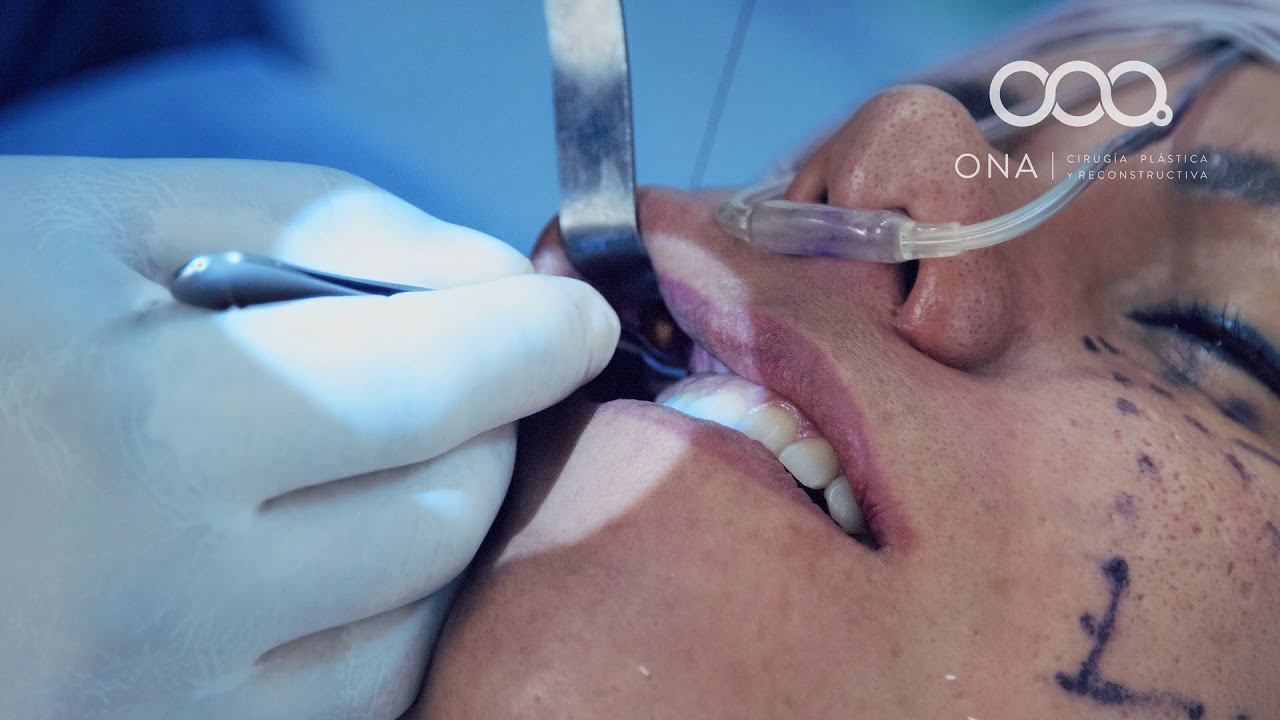 José Luis Segura Castillo-18