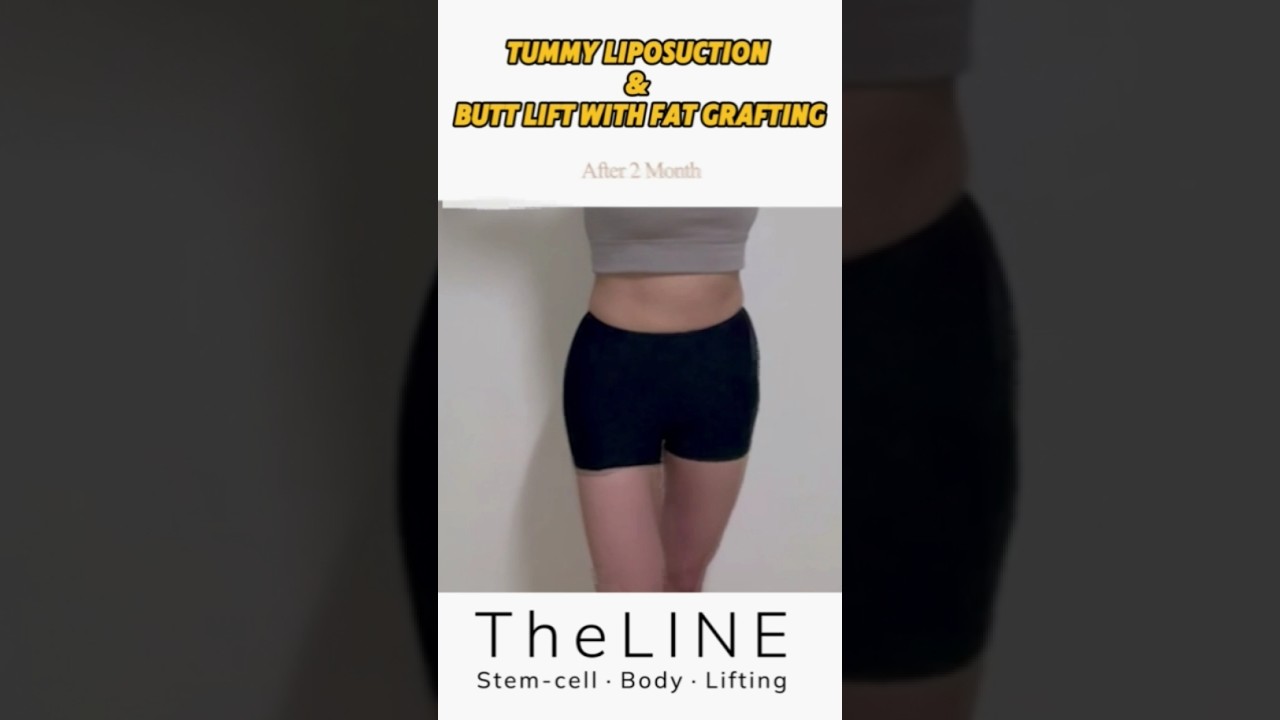 TheLINE shorts video