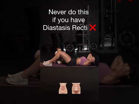 Diastasis Recti Exercises: What’s Safe ✅and What’s Not ❌🤰