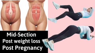 Exercises To Tighten Loose Skin Mid-Section, Diastasis Recti Healing - Abs For Holiday | Hana Milly