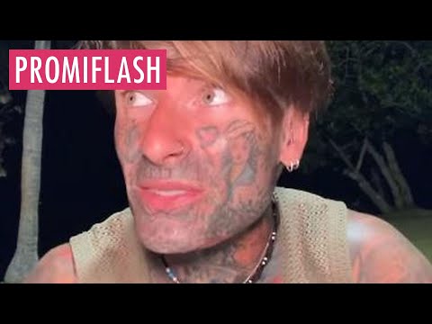 Video Thumbnail: Die Fans haben Mitleid mit Nikola Glumac wegen Panikattacke