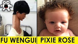 Top 10 Real Kids Born With Unbelievable Incredible Features