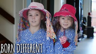 The Sisters Who Can&#39;t Go Out In Sunlight | BORN DIFFERENT