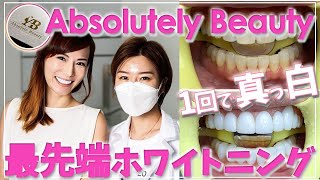 【劇的】wthattttt!?! Became so white !?! Singapore whitening theeth level!
