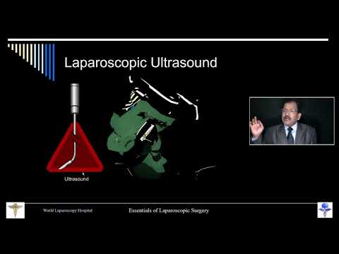 Laparoscopic Choledocolithotomy