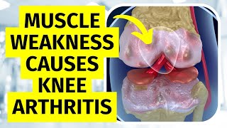 Knee Arthritis Muscle Weakness