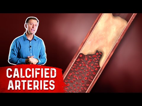 Calcium and Magnesium Absorption Basics – Dr Berg