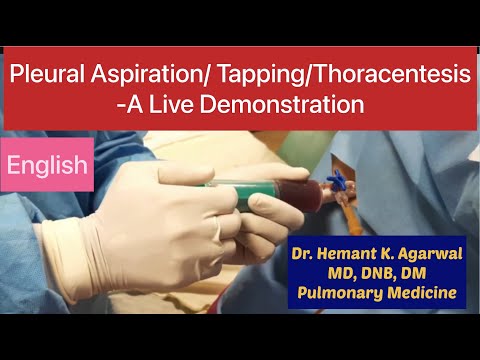 Pleural Aspiration/ Pleural Tapping/ Thoracentesis/ Needle Pleurocentesiss (English)