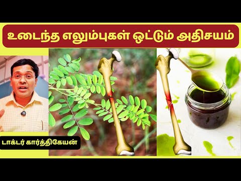உடைந்த எலும்புகளை ஒட்டும் அதிசயம் இந்த எண்ணெயில் உள்ளதா? bone fracture treatment oil