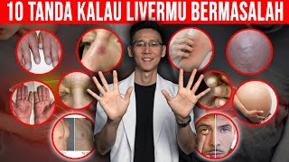 Download lagu 10 Tanda Di Kulit Pada Saat Liver atau Hati Bermasalah mp3