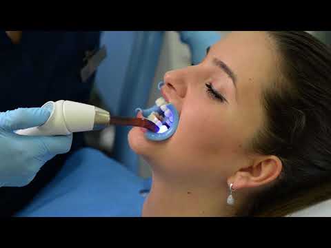 Dental Montenegro - izbjevljivanje