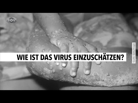 Erster Fall von Affenpocken in Baden-Württemberg | RON TV