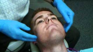 preview picture of video 'Lancaster,CA Dentist Demonstrates Oral Cancer Screening'