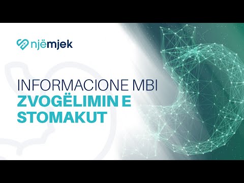 Informacione mbi Zvogëlimin e Stomakut
