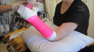 BROKEN HAND, VERY FIRST CAST, & MORE!