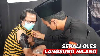 Download lagu A One-Sweep Method for Removing Tattoos, Discovered by the An Najach Islamic Boarding School in M... mp3