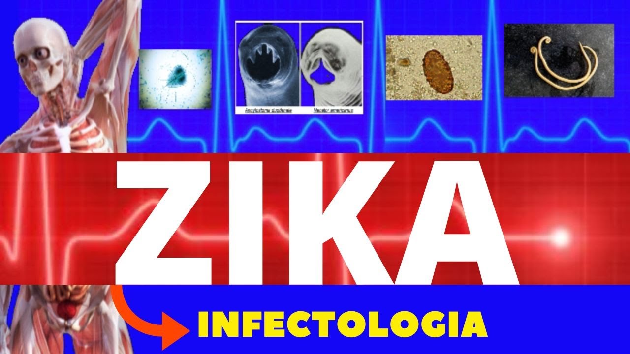 ZIKA VÍRUS - CAUSAS, SINTOMAS, DIAGNÓSTICO E TRATAMENTO - INFECTOLOGIA