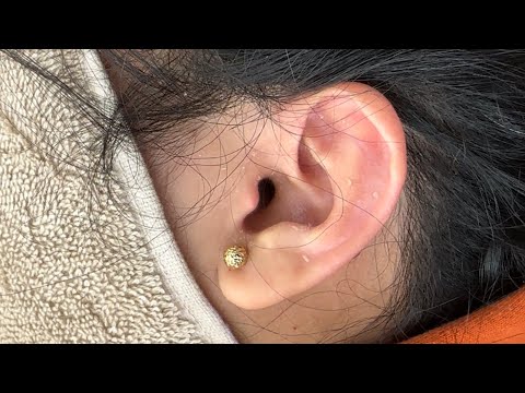 Cleaning Ears with Dry Skin ASMR (Zoomed in)