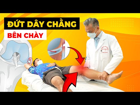 Lo Lắng Vì Đứt Bán Phần Dây Chằng Bên Chày? Phẫu Thuật Có Là Giải Pháp?