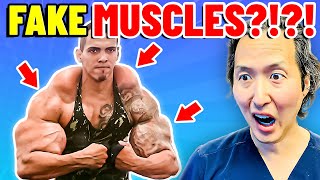 His HUGE Muscles KILLING HIM! EXTREME Bodies EXPLAINED!