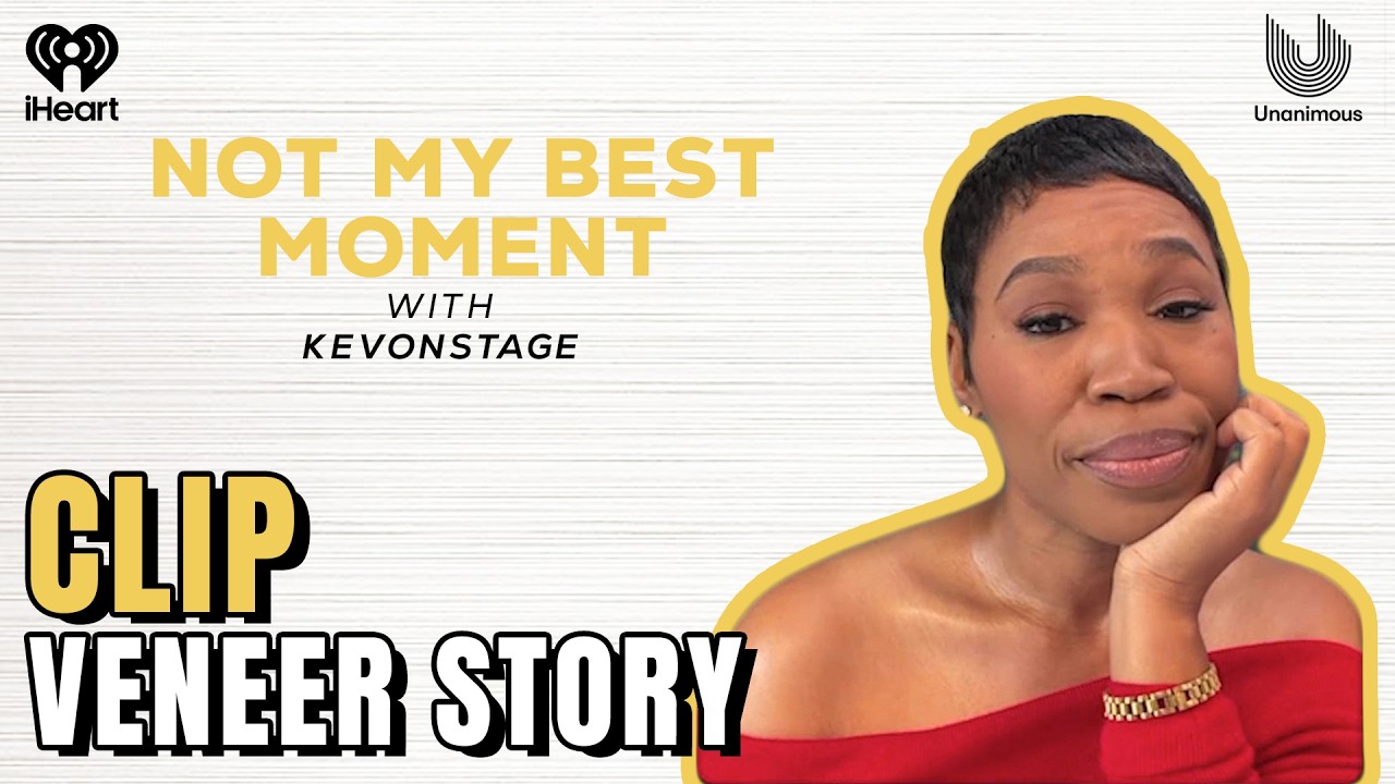 Veneer story | Not My Best Moment with KevOnStage