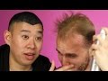 Balding Men Try Spray-On Hair