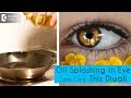 First Aid If Hot Oil Splashes In Eye While Cooking Dr Sunita Rana Agarwal