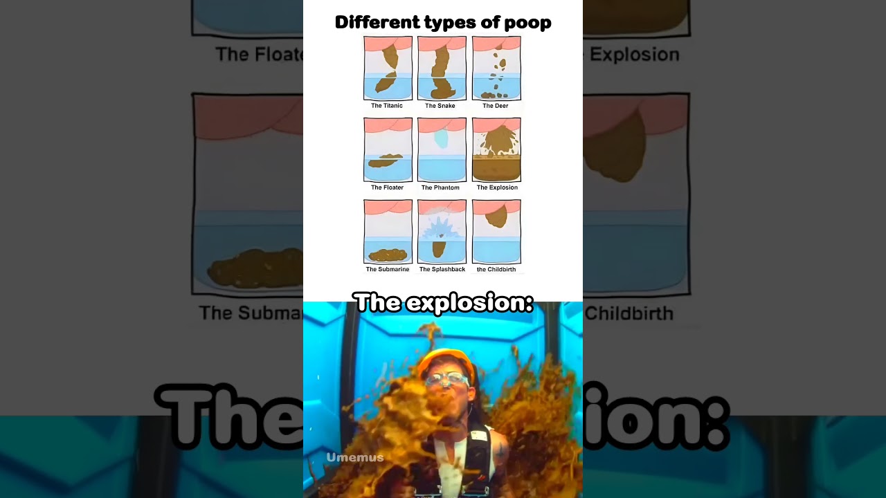 Different types of poop