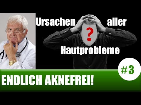 Das Ekzem die Nägel des Medikaments von den Händen Wenn die Schuppenflechte vom Wasserstoffperoxid zu behandeln