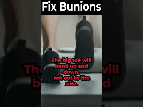TOP 13 Ways to Shrink Bunions Naturally 1 HUGE SECRET