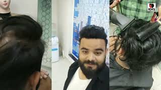 Hair Transformation | Hair Patches For Men | Patch Work In Hyderabad Branch | 9355443737 |