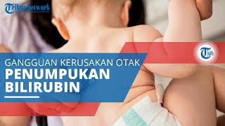 Kernikterus, Gangguan Kerusakan Otak yang Sering Terjadi pada Bayi akibat Penumpukan Bilirubin