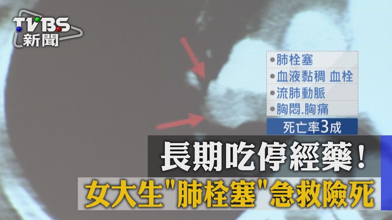 長期吃調經藥！　女大生肺栓塞急救險死