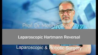 Miniaturka - Laparoscopic Hartmann Reversal. Metin Ertem MD.FACS